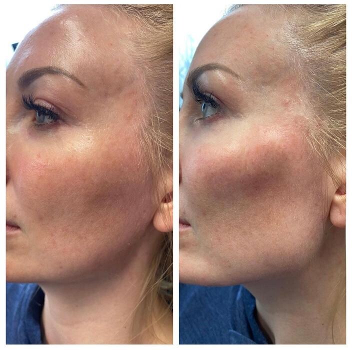 Images Blush Med Spa