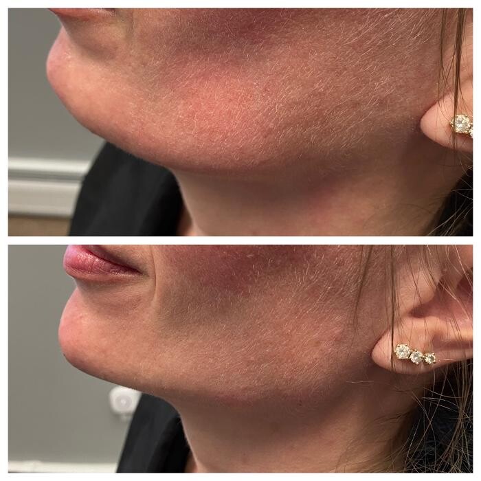 Images Blush Med Spa