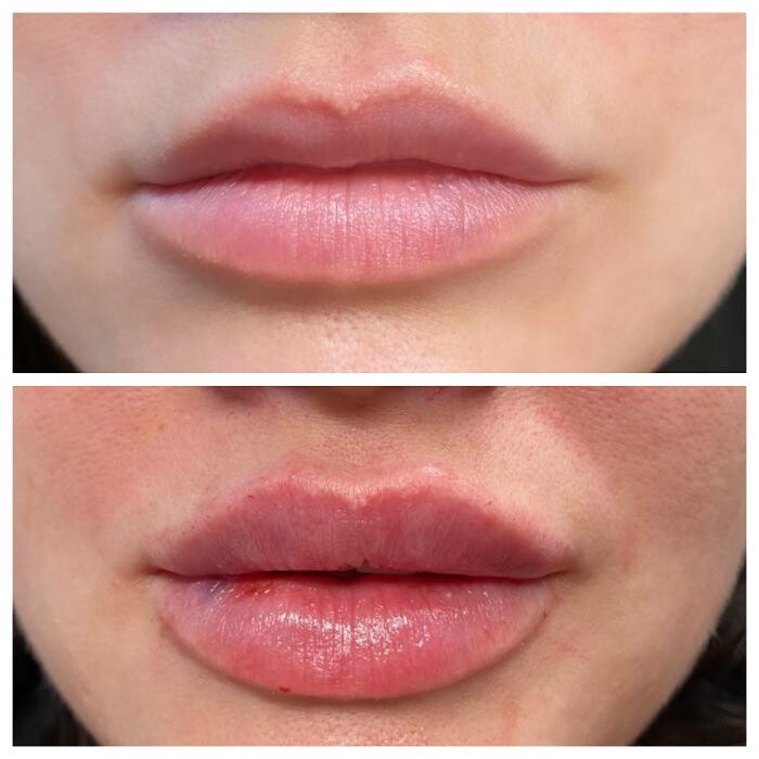Images Blush Med Spa