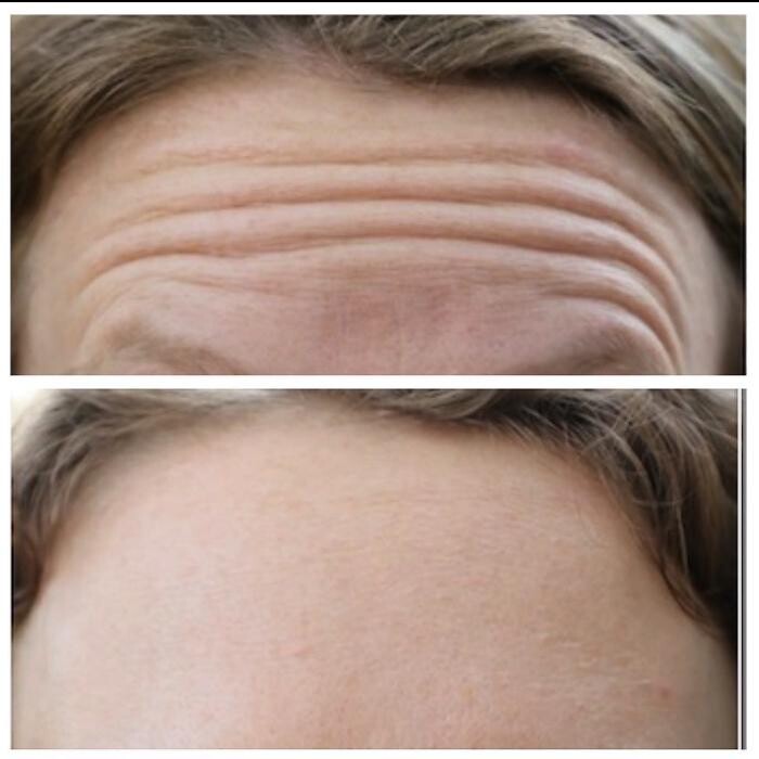 Images Blush Med Spa