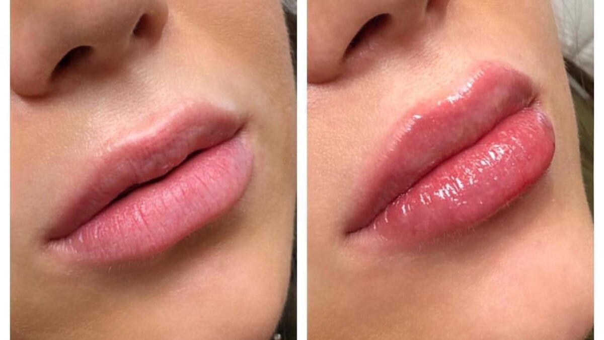 Images Blush Med Spa
