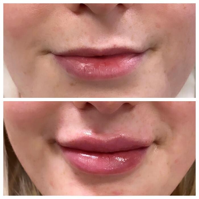 Images Blush Med Spa