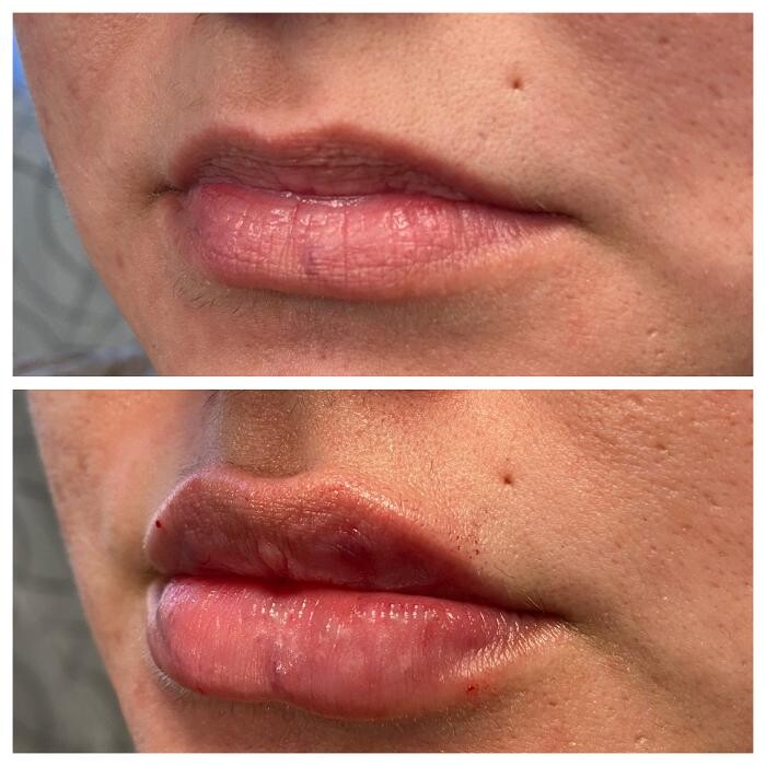 Images Blush Med Spa