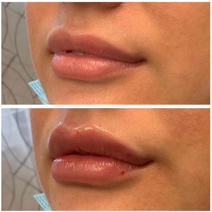 Images Blush Med Spa