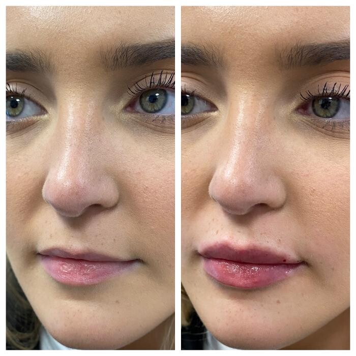 Images Blush Med Spa