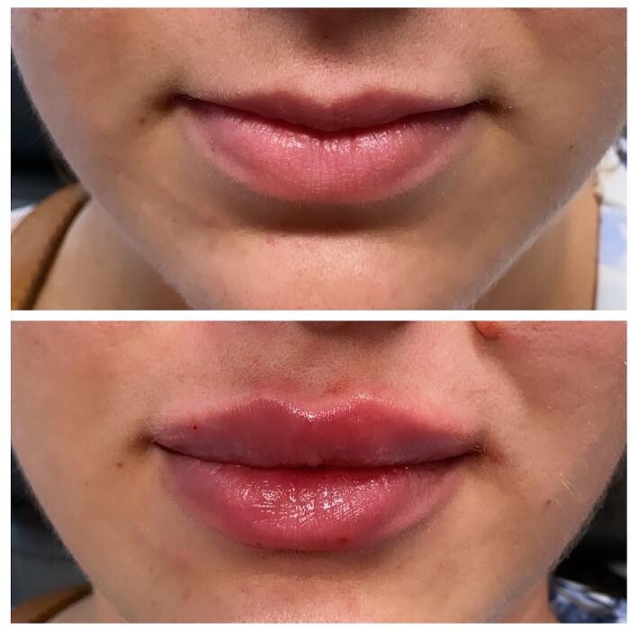 Images Blush Med Spa