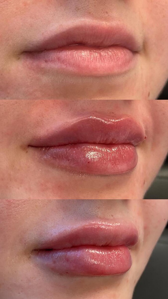 Images Blush Med Spa