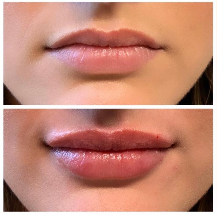 Images Blush Med Spa