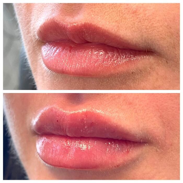 Images Blush Med Spa