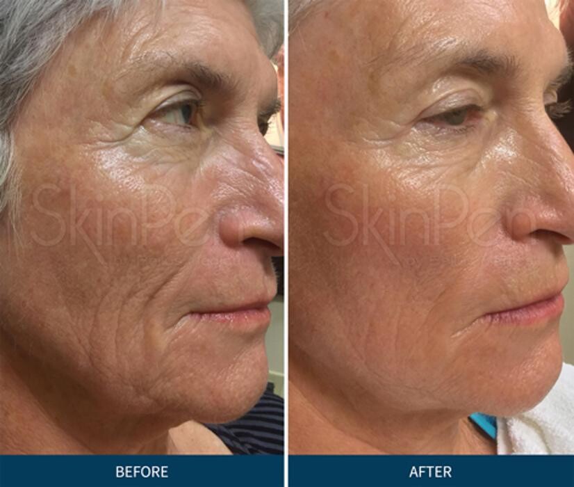 Images New Radiance Cosmetic Centers