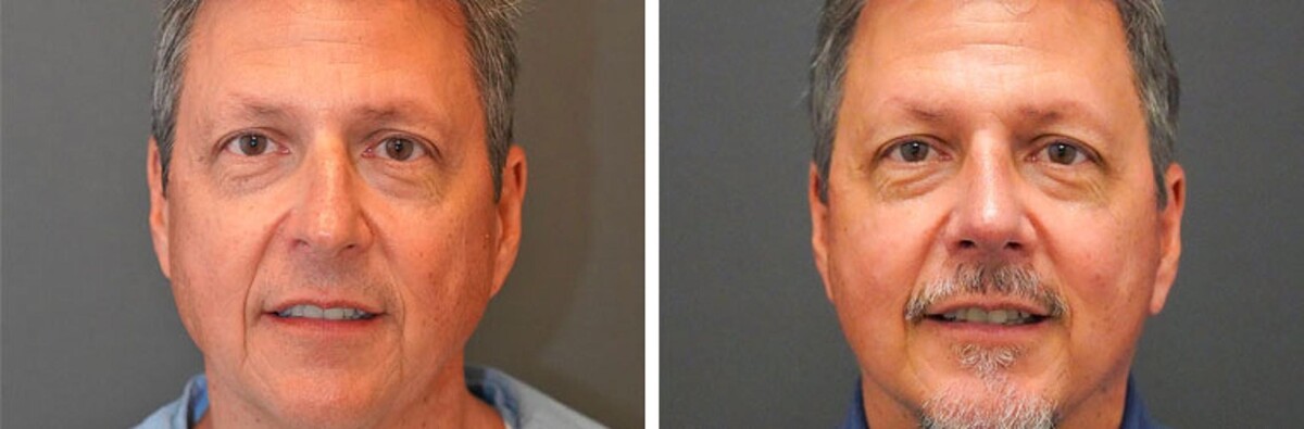 Images Synergy MedAesthetics