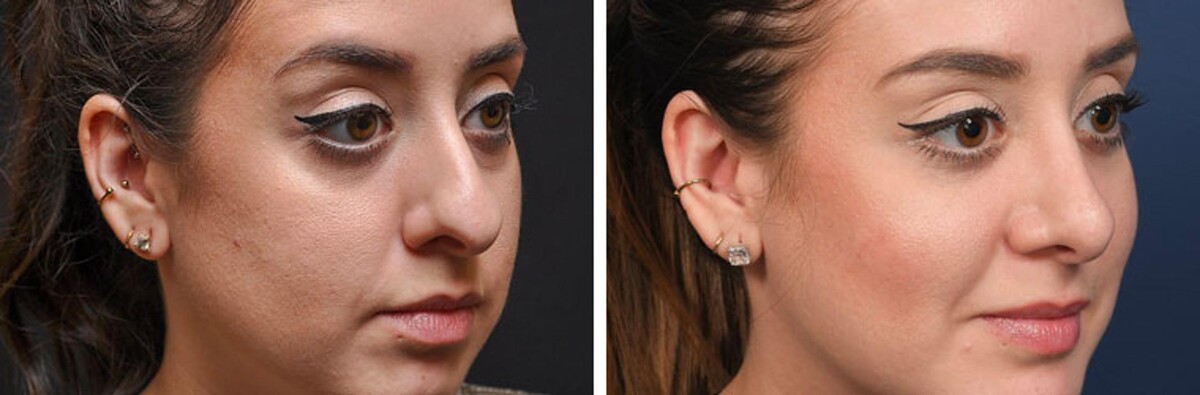 Images Synergy MedAesthetics