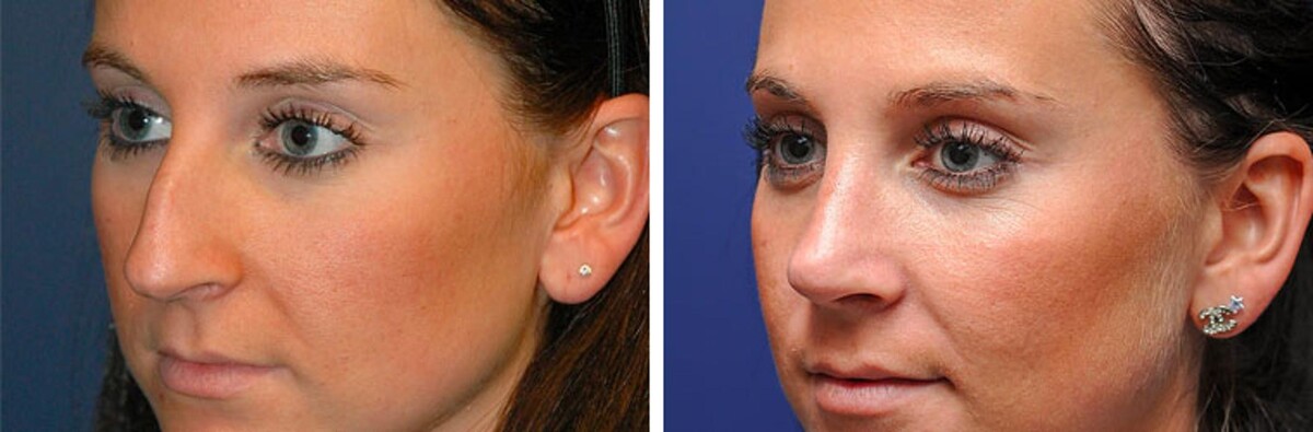 Images Synergy MedAesthetics