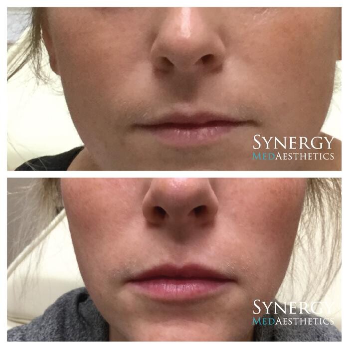 Images Synergy MedAesthetics