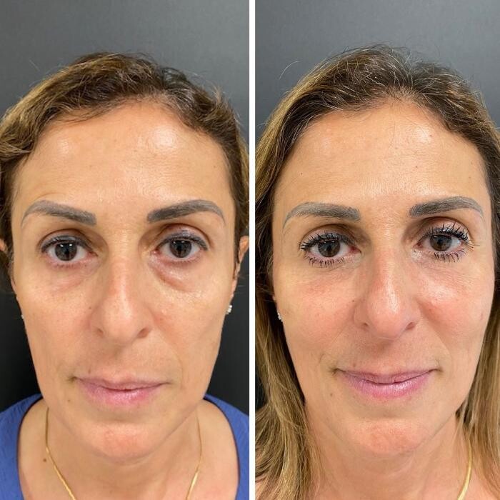 Images LivingYoung Center for Health & Anti-Aging