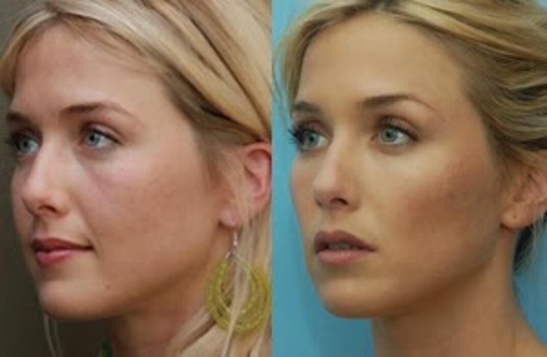 Images New Radiance Cosmetic Centers
