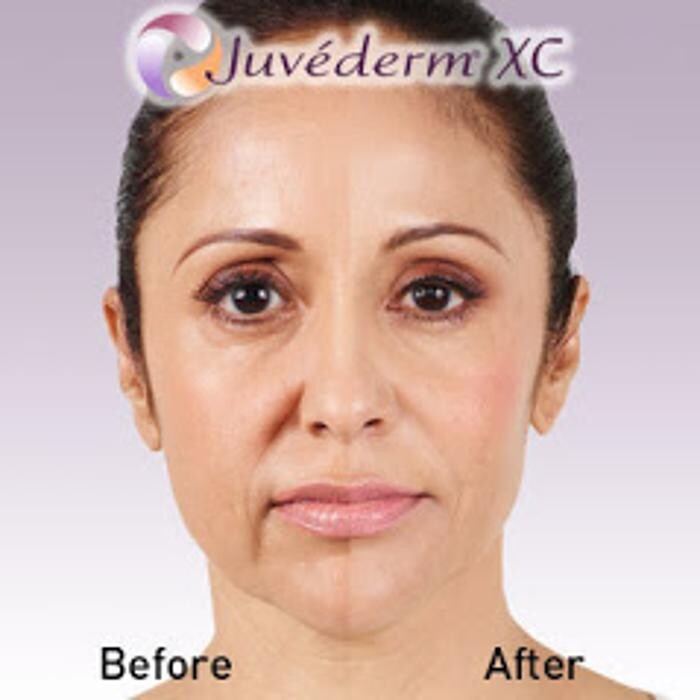 Images New Radiance Cosmetic Centers
