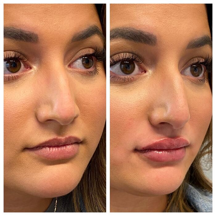Images Blush Med Spa