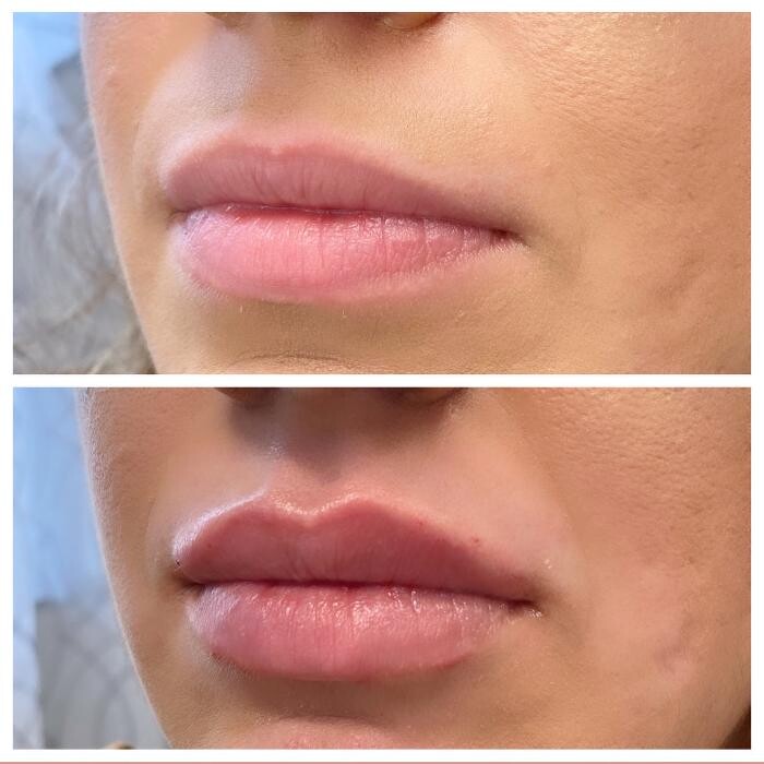 Images Blush Med Spa