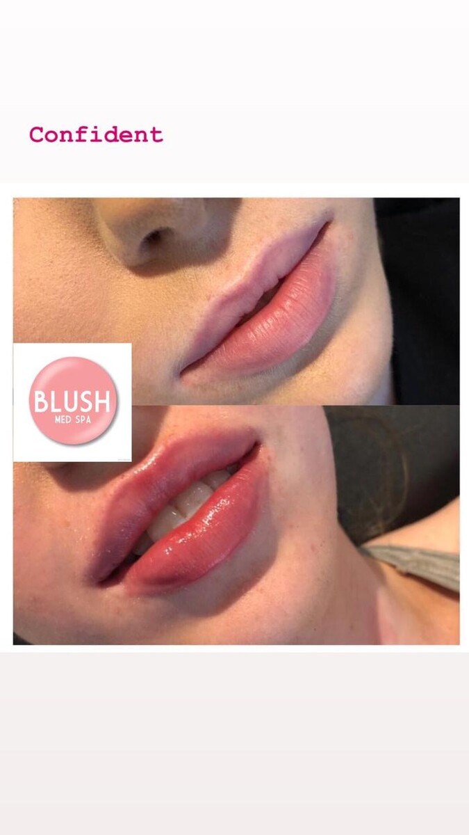 Images Blush Med Spa