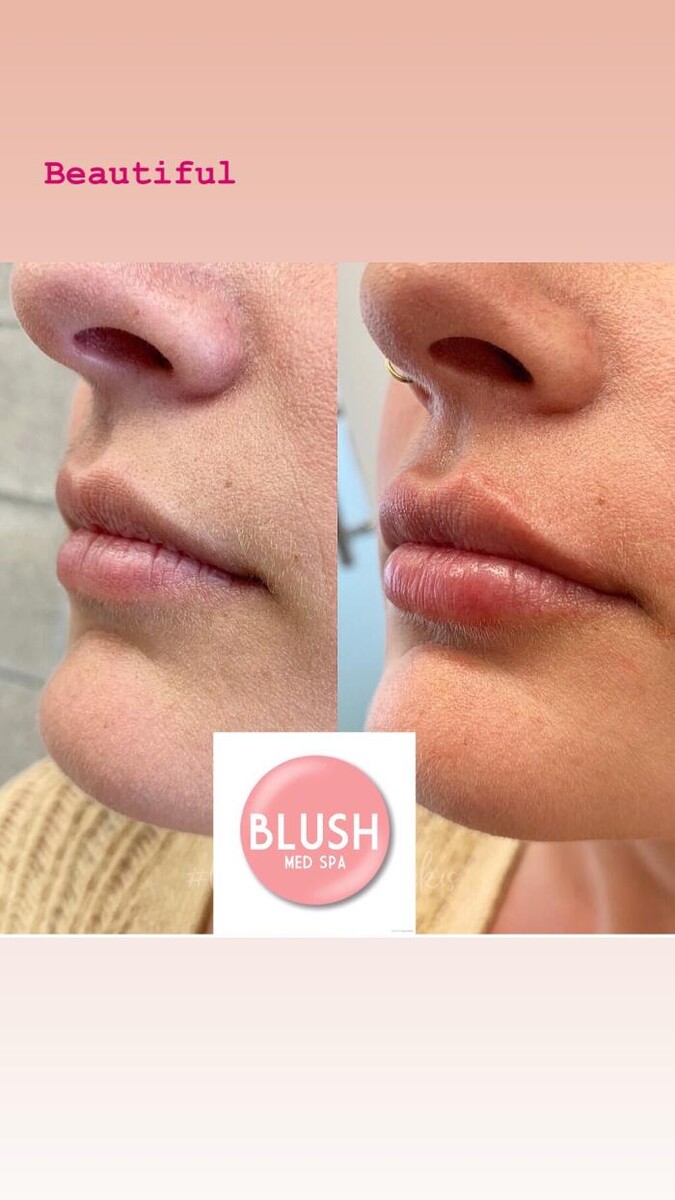 Images Blush Med Spa