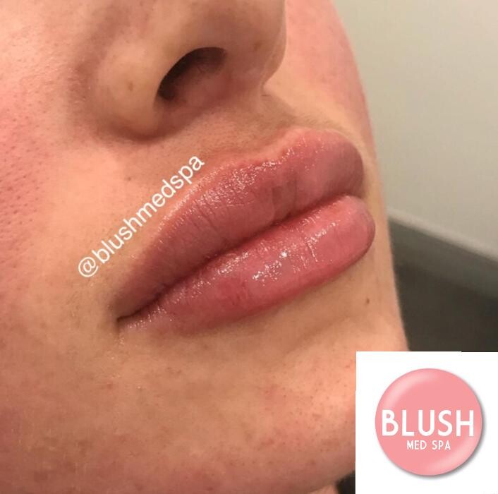 Images Blush Med Spa