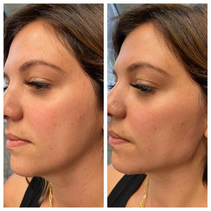 Images Blush Med Spa
