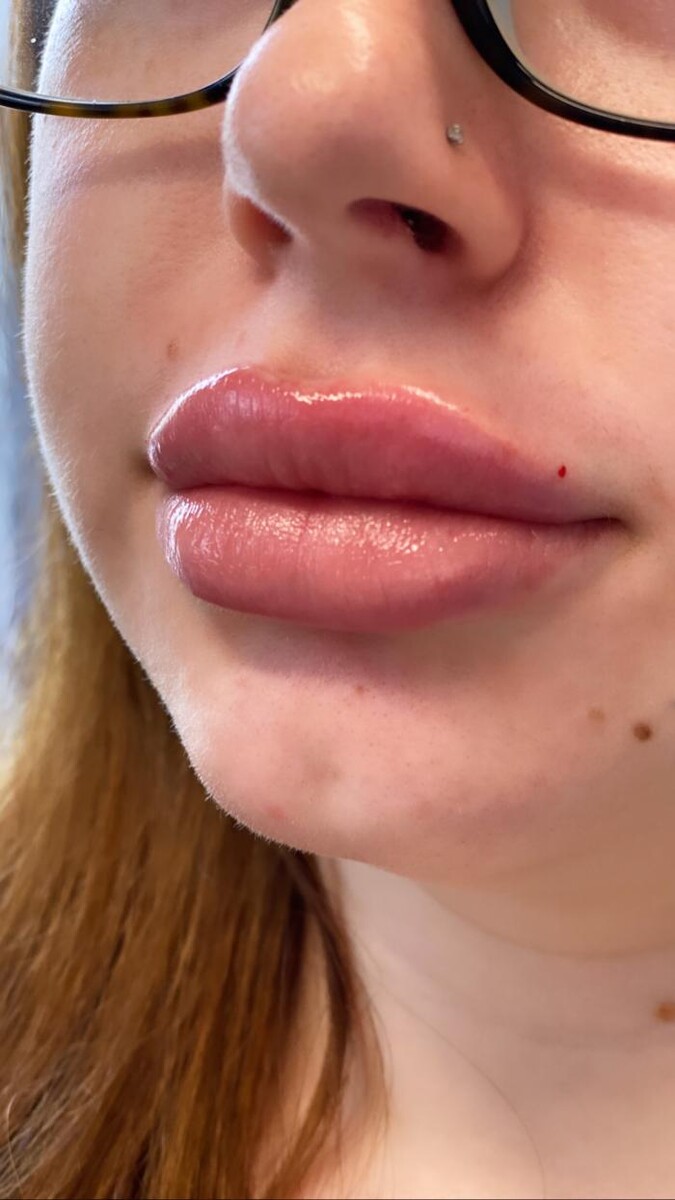 Images Blush Med Spa