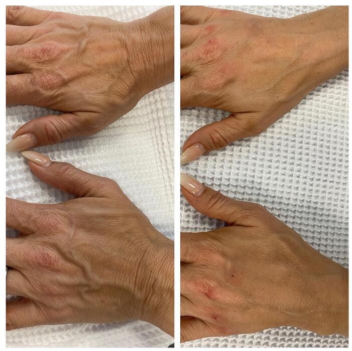 Images Blush Med Spa