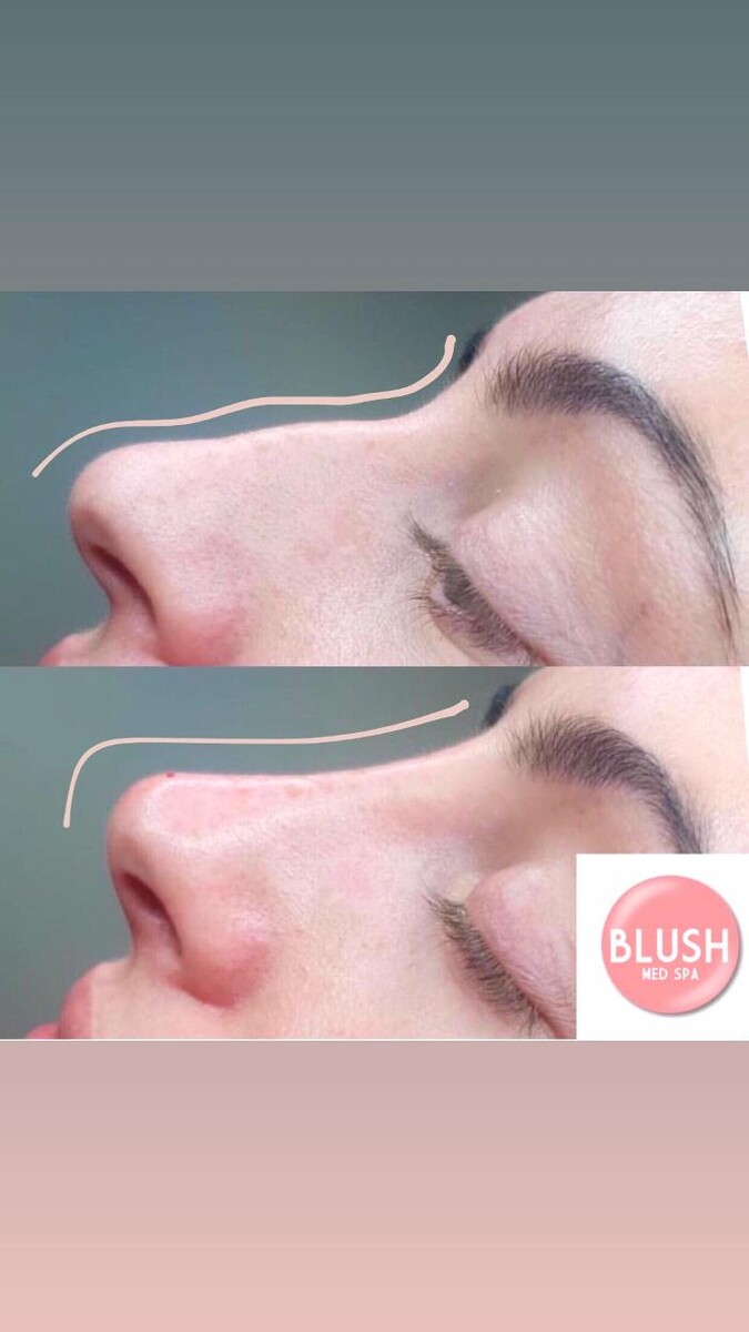 Images Blush Med Spa