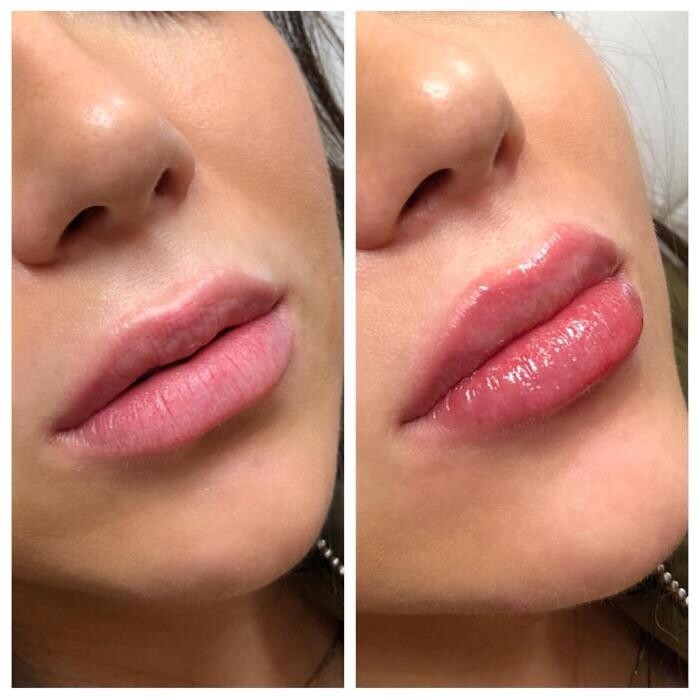 Images Blush Med Spa
