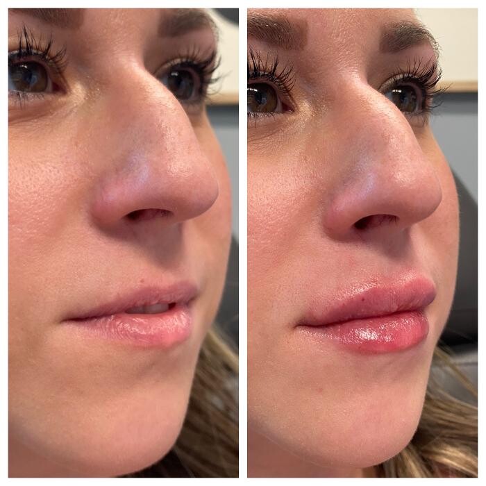 Images Blush Med Spa