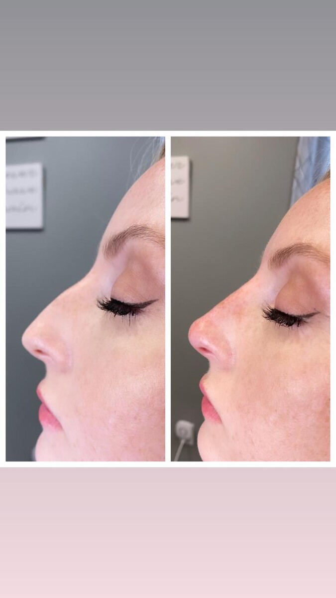 Images Blush Med Spa