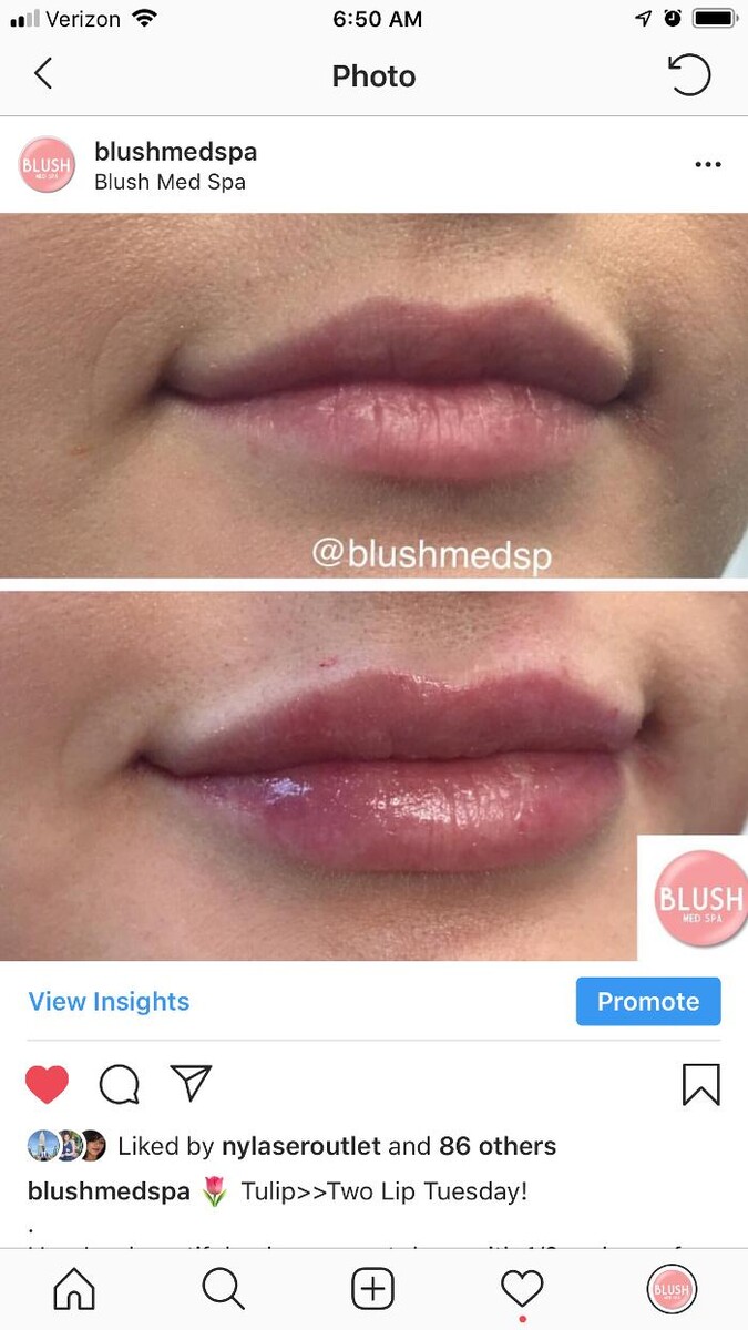 Images Blush Med Spa