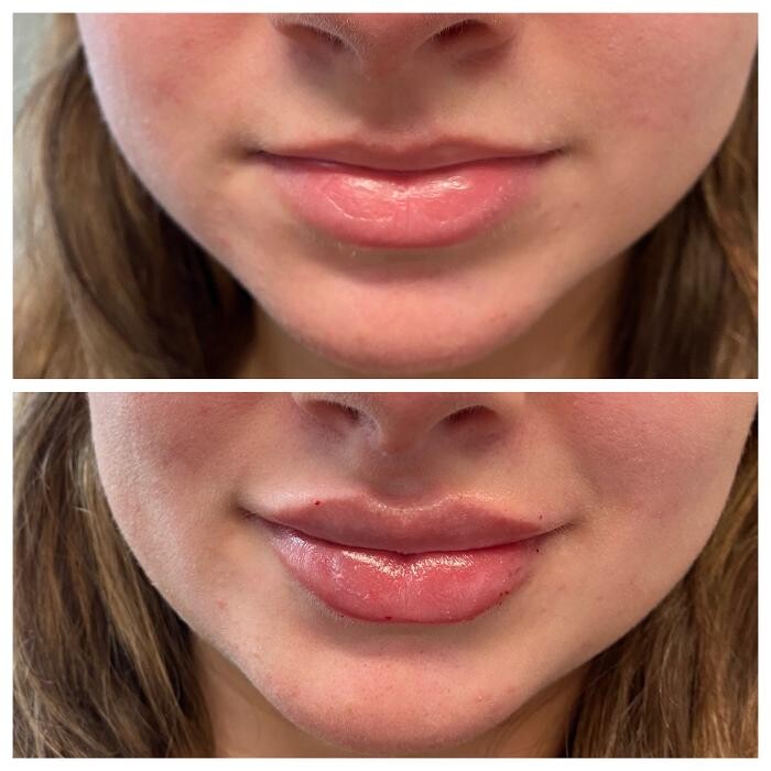 Images Blush Med Spa