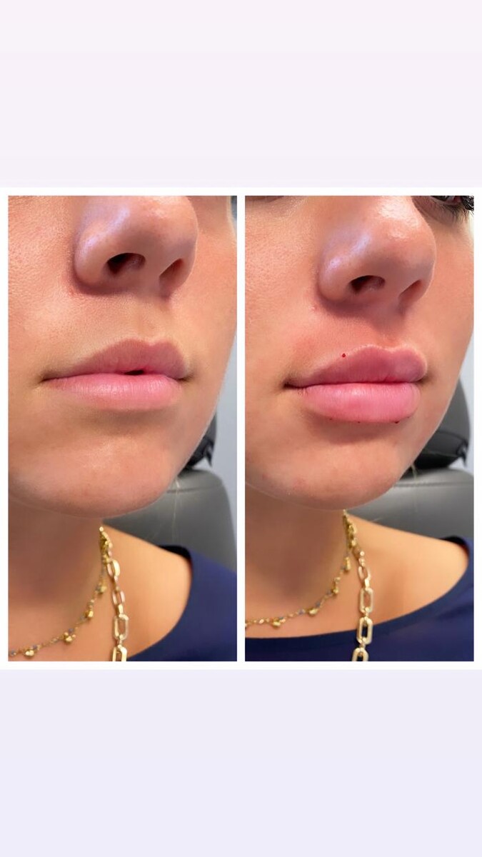 Images Blush Med Spa