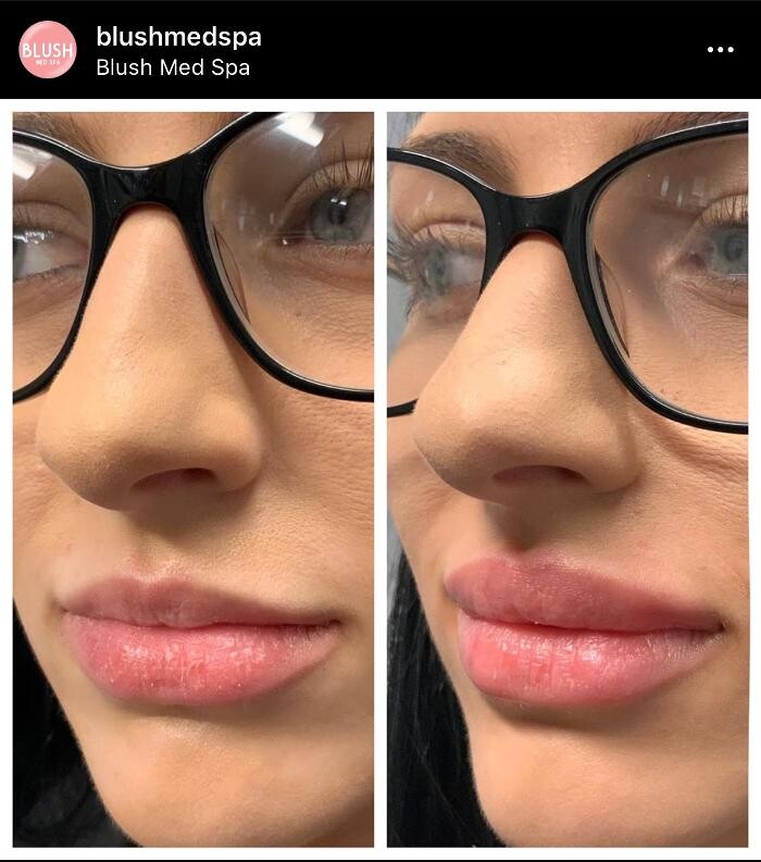 Images Blush Med Spa
