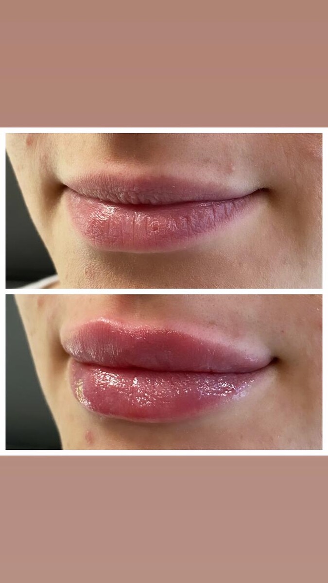 Images Blush Med Spa