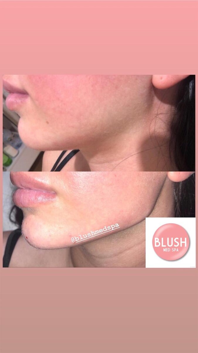 Images Blush Med Spa