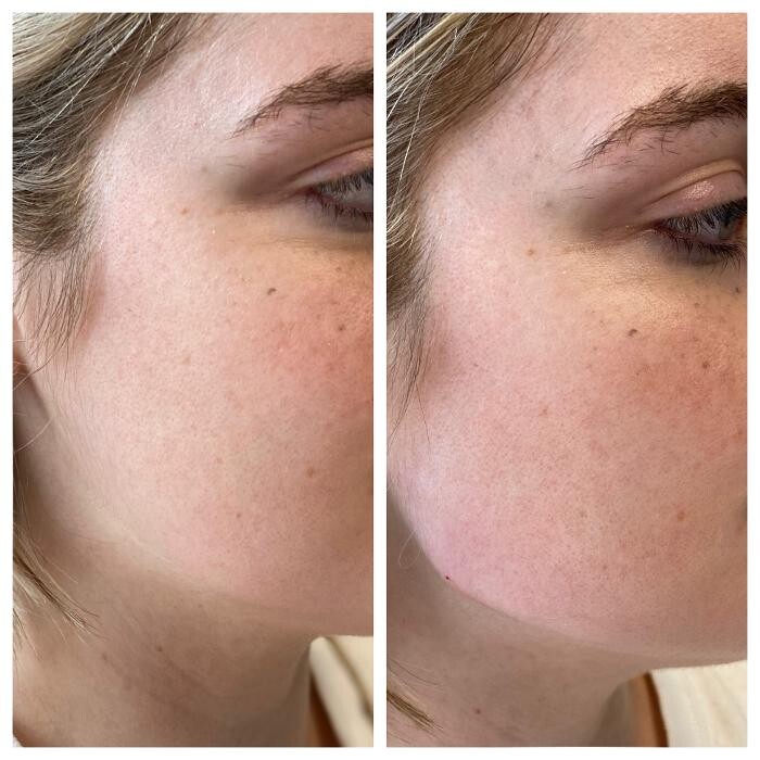 Images Blush Med Spa