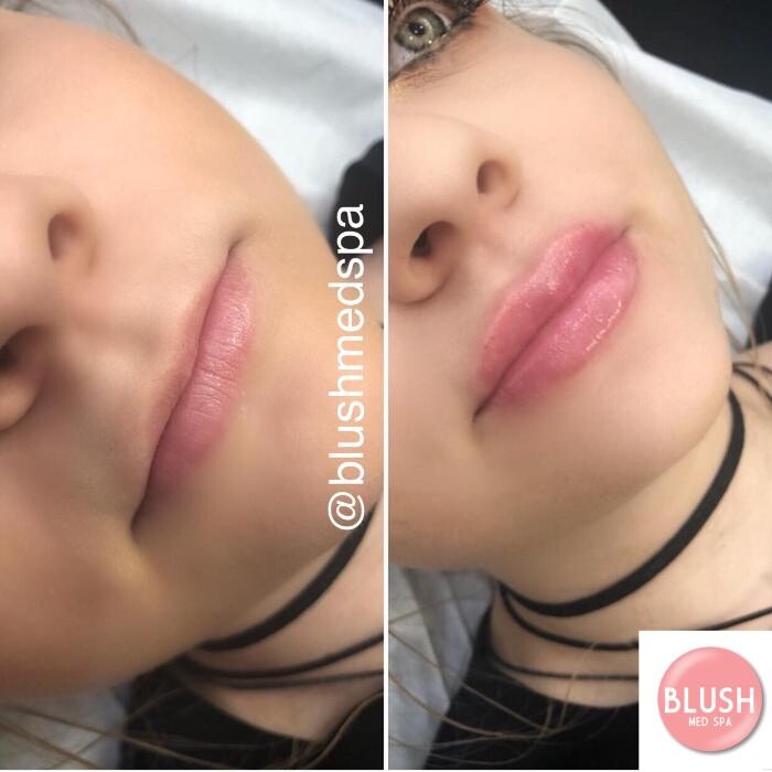 Images Blush Med Spa