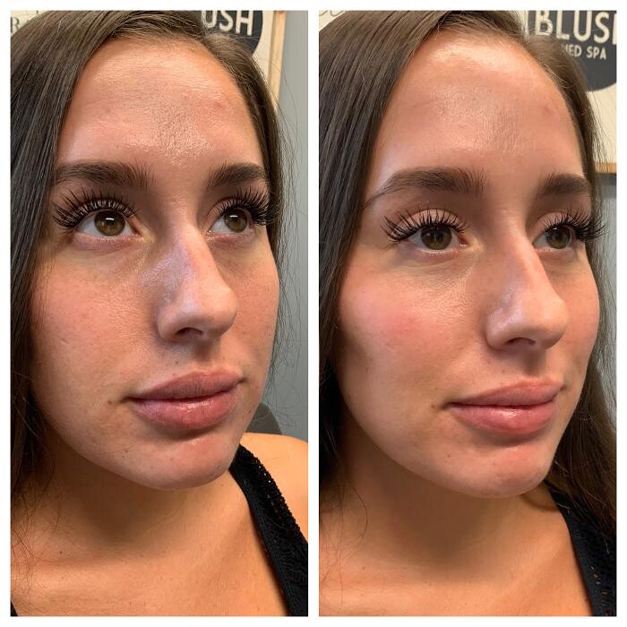 Images Blush Med Spa