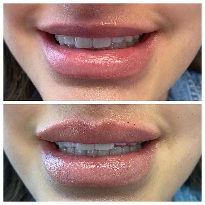 Images Blush Med Spa