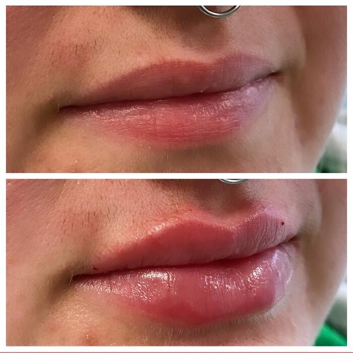 Images Blush Med Spa