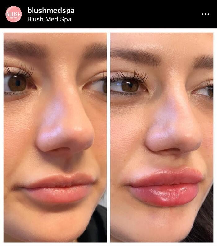Images Blush Med Spa