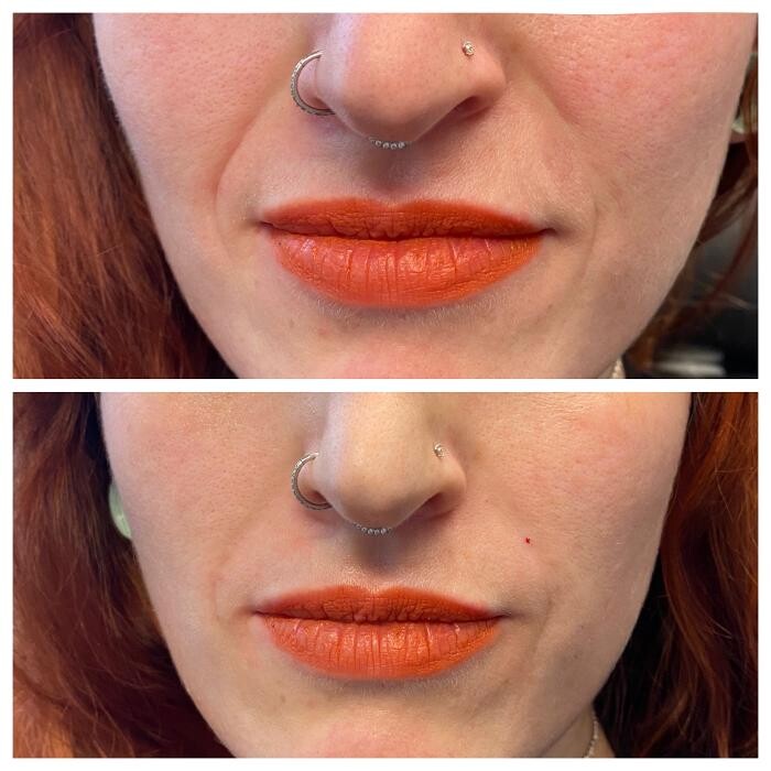 Images Blush Med Spa