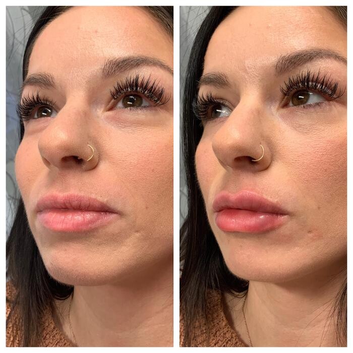 Images Blush Med Spa