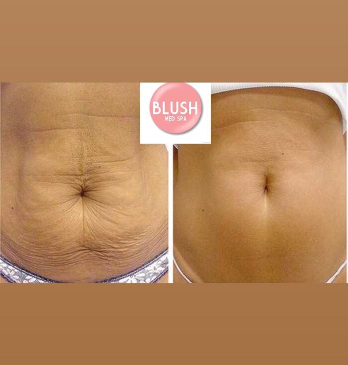 Images Blush Med Spa