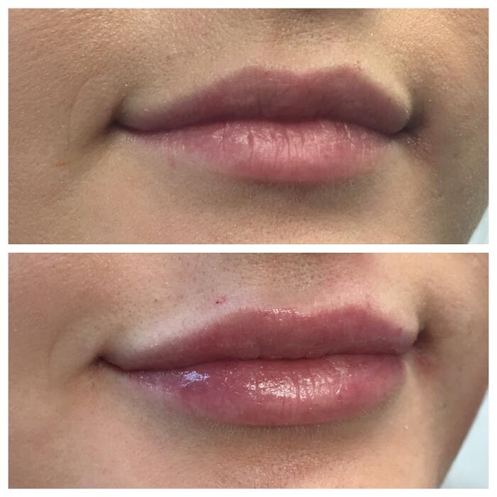 Images Blush Med Spa