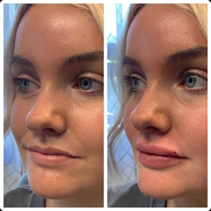 Images Blush Med Spa
